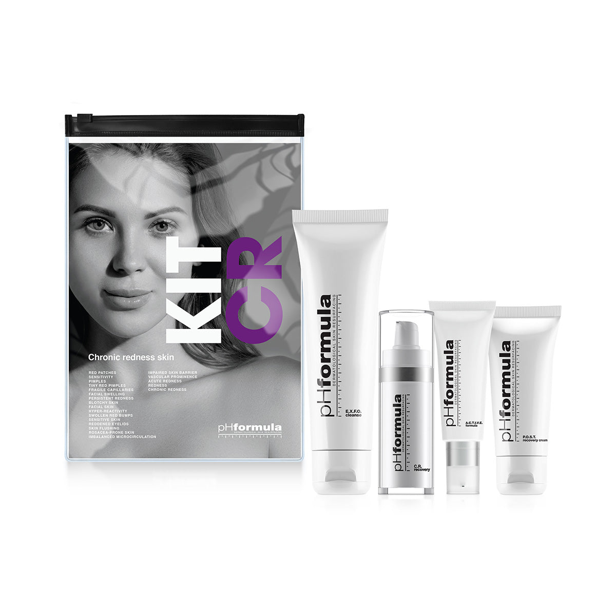 4-step skincare kit for distressed and sensitive skin, designed to calm irritation, restore barrier function, and prevent future damage